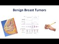 Benign Breast Conditions | USMLE COMLEX NCLEX