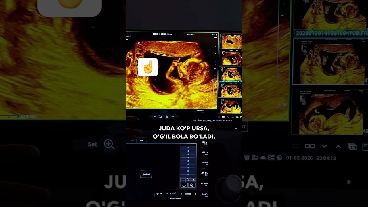 Alloh buyuk☝️ #shortvideo #pregnant