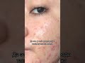 Капельница золушка/MediOk, ссылка для связи в шапке профиля #косметологмосква #очищениеорганизма