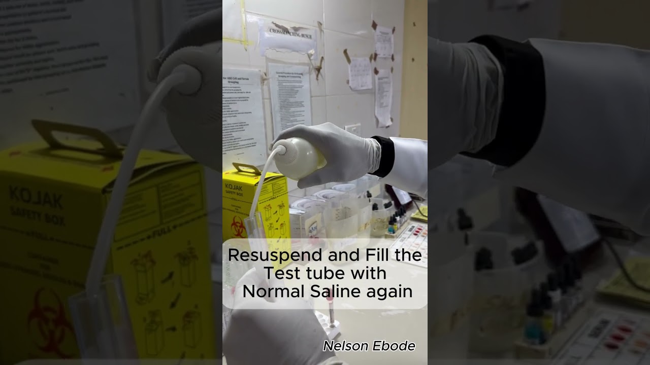 How to wash red blood cell 