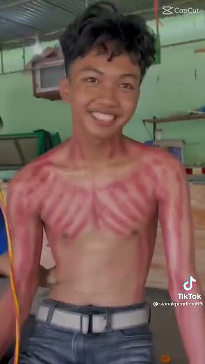 Kerokan cowok ganteng part 1 #kerokan #kerokanmasukangin #kerokancowokganteng #buluketekcowok