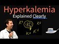 Hyperkalemia Explained Clearly - Fluid and Electrolyte Imbalances