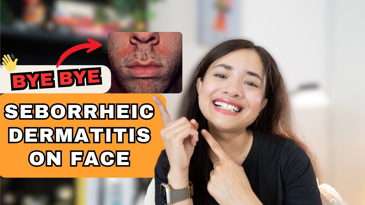 Seborrheic Dermtitis on Face Keeps Coming Back? Here’s How to Stop It