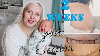 MY C SECTION RECOVERY | 2 WEEKS POSTPARTUM AND BABY UPDATE! | GUIDING RAINBOWS