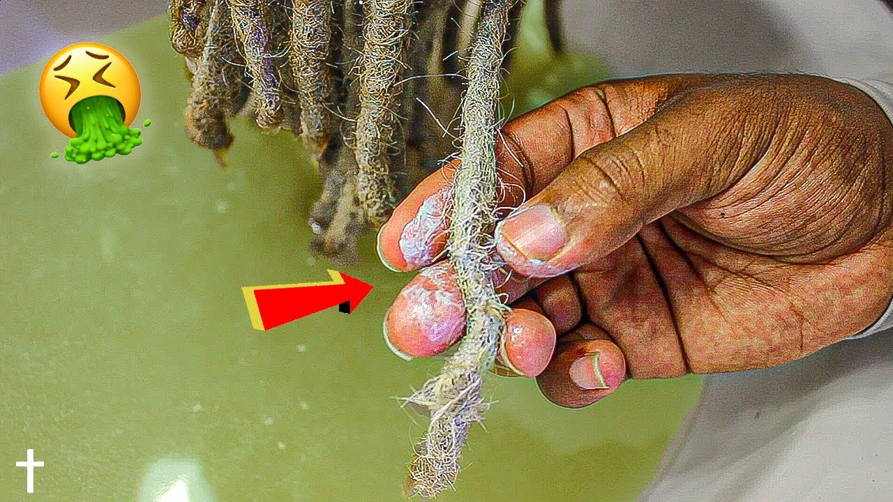NASTY ACV Rinse Transformation On Dreadlocks 🤢🤮 - YouTube