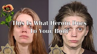 What Heroin Does To Your Body |Devastating Effects Of Heroin On Your Body