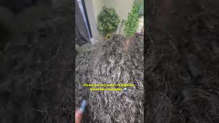 Stop Scratching! 🛑 Is it Dandruff or Seborrheic Dermatitis? | Scalp Care 101