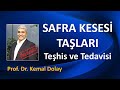 Safra kesesi talari tehs ve tedavs  prof dr kemal dolay