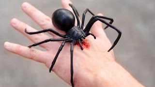 GIANT BLACK WIDOW BITE!