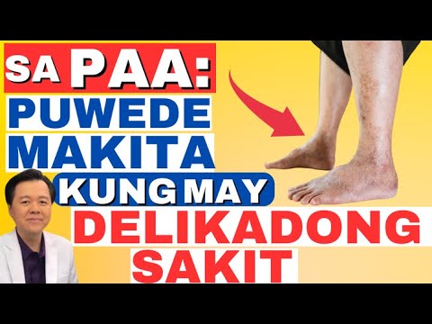 Video: Parang patay na pantapal. Ano ang ibig sabihin nito?