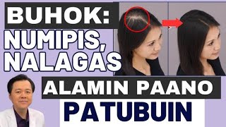 Buhok: Numipis, Nalagas Alamin Pano Patubuin - By Doc Willie Ong (Internist and Cardiologist)