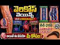 Why Varicose Veins Happen? Complete Guide + Yoga &amp; Diet | Natural Healing Solution|Dr. Nirmala Devi