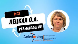 Прохождение медико-социальной экспертизы при РЗ #ревматология #инвалидность