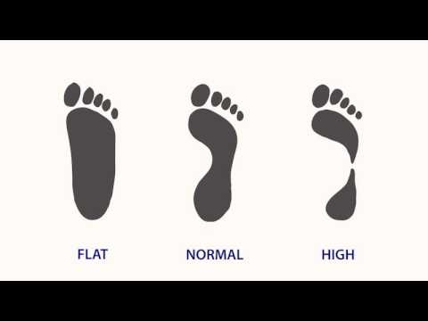 Video: Čo je to šmrncovná noha?