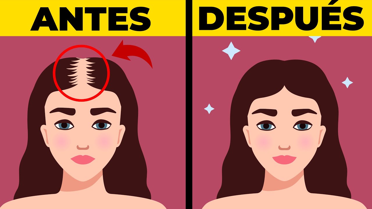 TOP 10 COMO EVITAR LA CAIDA DEL CABELLO YouTube