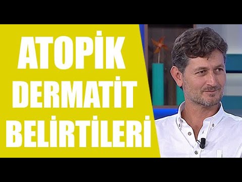 Atopik Dermatit nedir? Alerjiden nasıl korunuruz?