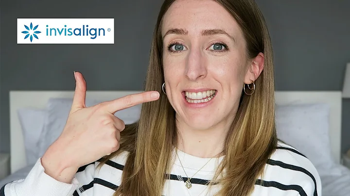 INVISALIGN HALFWAY POINT UPDATE! | Progress Photos...