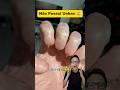 N&atilde;o Possui Unhas 😱#medicina #medico #enfermagem #enfermeiro #enfermeira #manicure #unhas Anon&iacute;quia