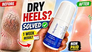 Be Bodywise Urea Foot Roll On Review | 2026 | Be Bodywise Cracked Heel Roll On