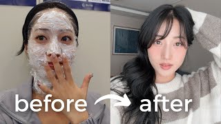 extreme glow up in korea  glass hair, nail art, haircut & color, LED lashes, laser skin treatments