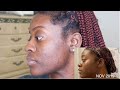1 MONTH SHEA BUTTER UPDATE | ( DID IT WORK ?!)