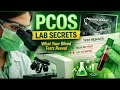PCOS Explained by the Lab: What Your Blood Tests Are Really Saying