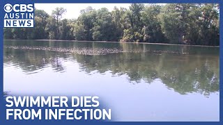Tragic brain infection death tied to Texas lake