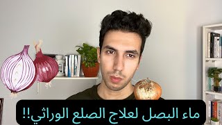 ماء البصل لعلاج الصلع الوراثي + حلول للتخلص من رائحته