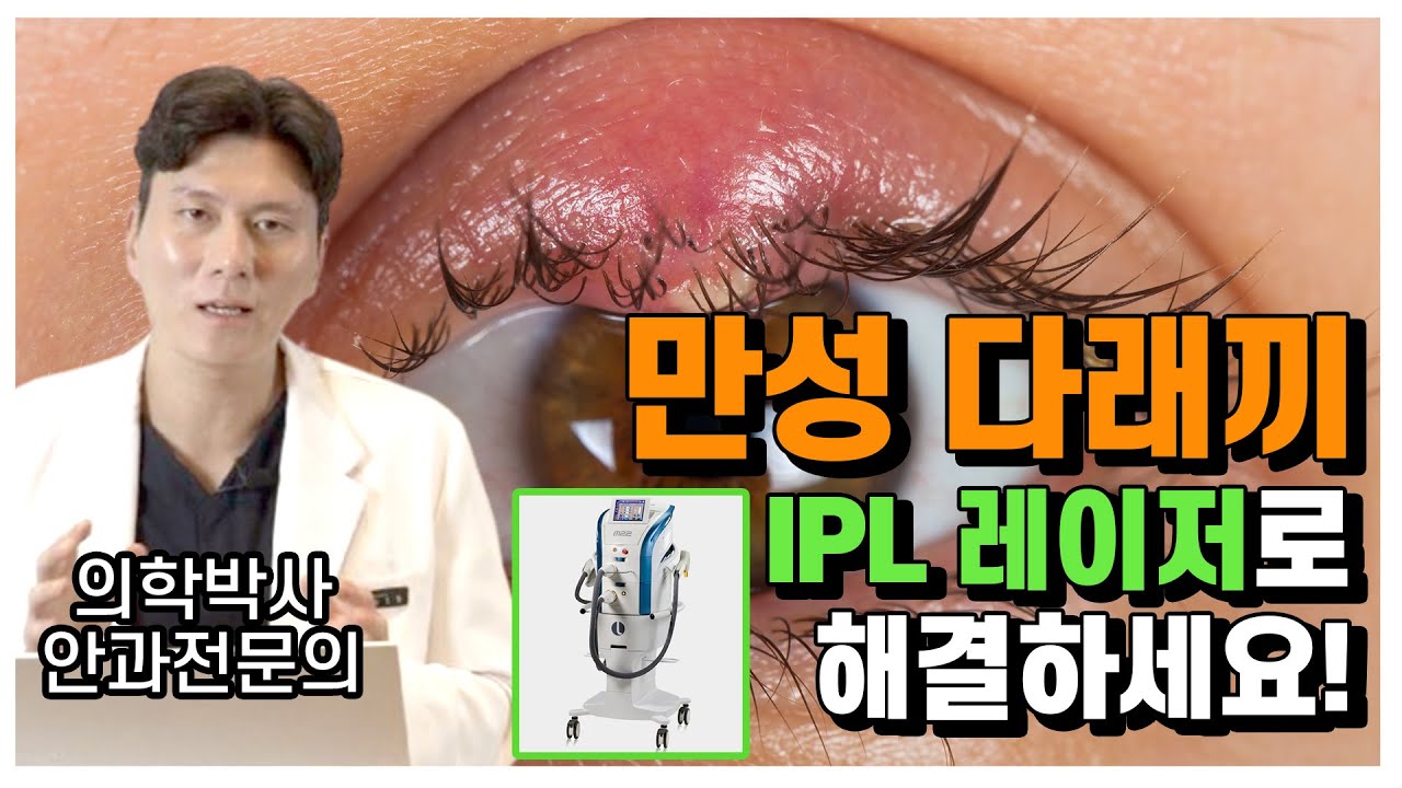 [Сонгму Жин Нүдний Эмнэлэг] Нүдний шар будаа байнга гардаг үед шийдэл ✨ [Анагаах уухааны доктор, ерөнхий захирал эмч Пак Жинхён]