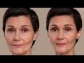 CÁCH TRỊ NÁM HIỆU QUẢ