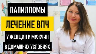 Лечение ВПЧ у женщин и мужчин. Чем и как лечить вирус папилломы человека в домашних условиях