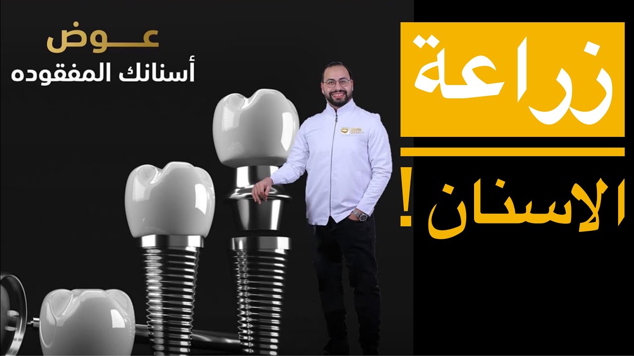 تعمل زراعة اسنان ولا تركيبة لأسنانك افضل ؟ كيف تتم عملية زراعة الاسنان؟!