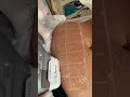 Gordura Localizada! Procedimento Ultraformer 3