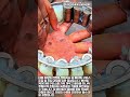 대형 휠 베어링 구리스 주입 및 롤러 조립 과정 #worker #process #bearing #grease #maintenance
