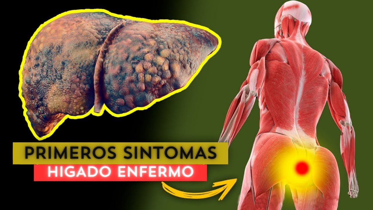 ALERTA! el HIGADO se está DETERIORANDO 10 Señales de daño HEPÁTICO ...