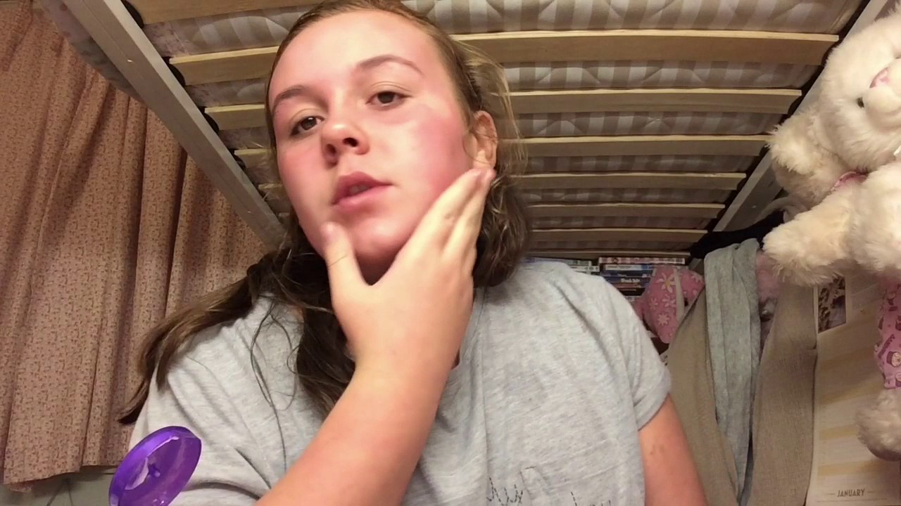 Allergic reaction to face mask????? YouTube