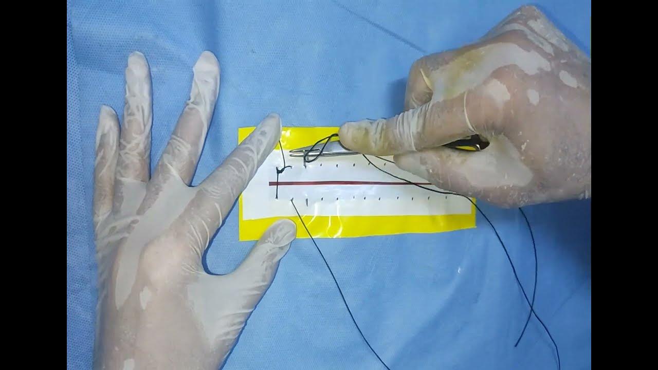 Puntos de sutura adhesivos cuando quitarlos