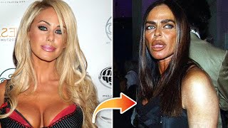 10 Worst Celebrity Plastic Surgery Disasters
