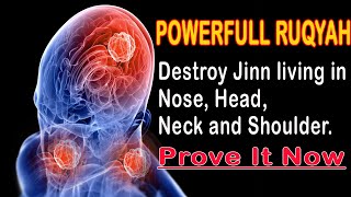 Powerful Ruqyah to Destroy Jinn living in Nose, Head, Neck and Shoulder.