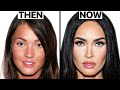 Megan Fox SHOCKING Plastic Surgery Transformation