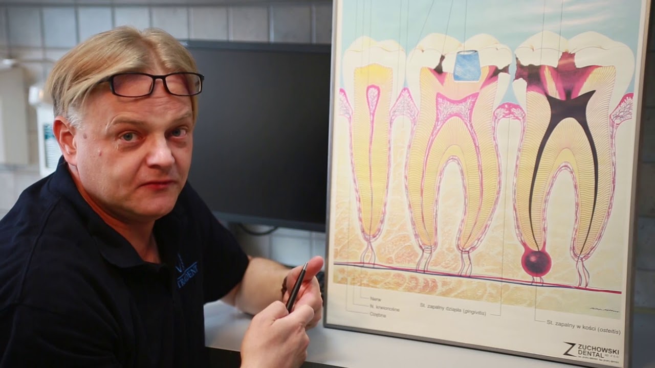 Dlaczego bolą nas zęby?