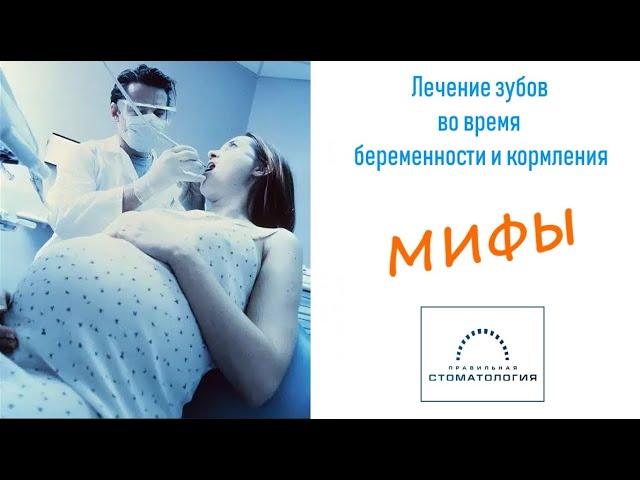 Мифы о лечение зубов во время беременности и кормления