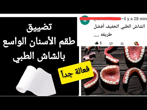 أفضل طريقة لتضييق طقم الأسنان الواسع بالشاش الطبي. طريقة منزلية فعالة مجربة وإقتصادية👈جربها ولن تندم