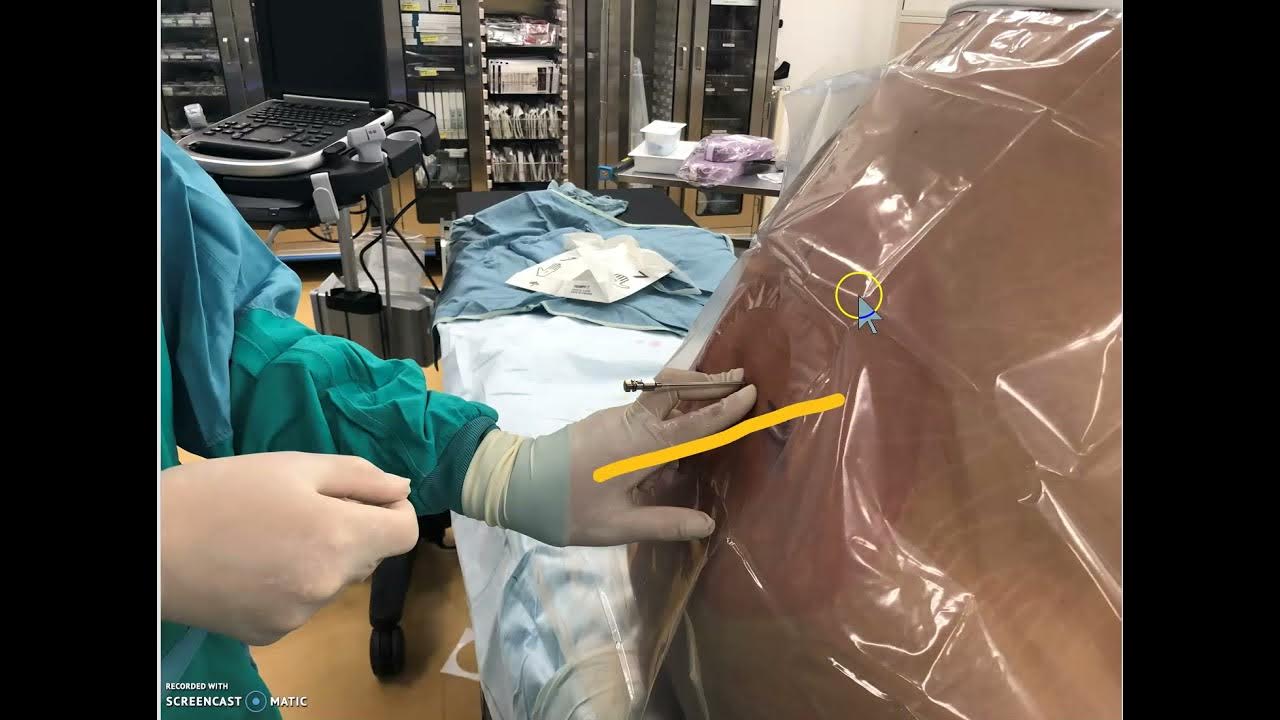 Lumbar/spinal drain insertion from start to finish setting it up