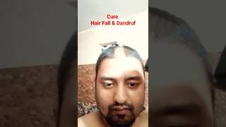 Hair fall & dandruf ka solution hairfall dandruff hairlosstreatment shortsfeed viral shorts