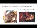 Orf Disease In Goats Treatment