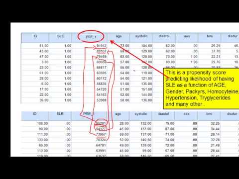 Video: Úloha Pooperační Radioterapie V Dermatofibrosarkomových Protuberanech: Propensity Score-matchched Analysis