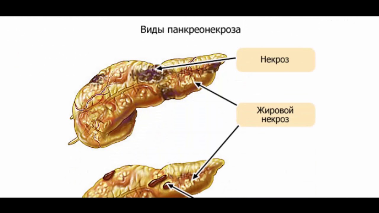 Поджелудочная свиньи