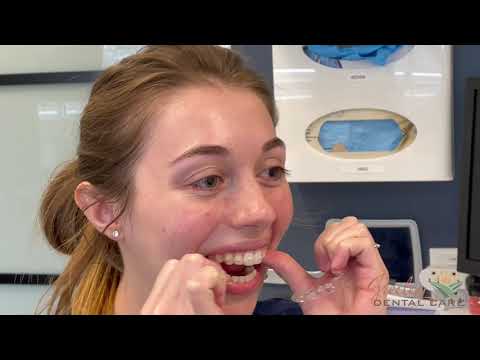 Video: Jak vložit nový zásobník Invisalign (s obrázky)