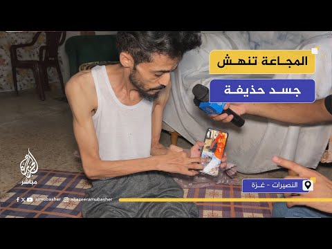 المجاعة تنهش جسد الشاب الرياضي حذيفة في غزة
